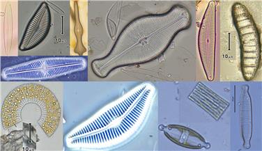 Seit kurzem ist auch die Verbreitung der Kieselalgen in Südtirols Gewässern online. Die Aufnahme am Mikroskop bei 1000-facher Vergrößerung gibt Einblick in ihre Formen- und Strukturvielfalt. Foto: Landesagentur für Umwelt und Kli