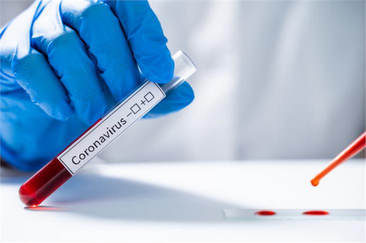Im Auftrag des Südtiroler Sanitätsbetriebes wurden bisher 92.044 Abstriche von 46.009 Personen auf das neuartige Coronavirus untersucht. (Symbolbild: it.freepik.com)