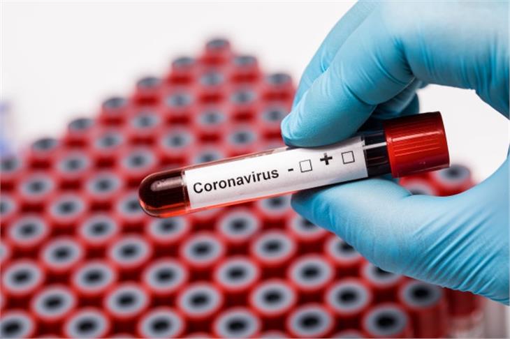 Im Auftrag des Südtiroler Sanitätsbetriebes wurden bisher 107.735 Abstriche von 55.757 Personen auf das neuartige Coronavirus untersucht. (Symbolbild: it.freepik.com)