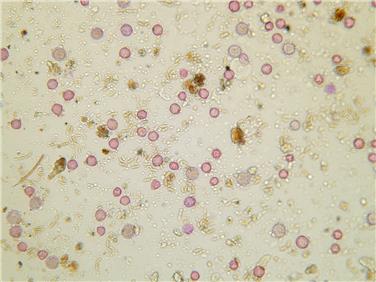 Visto dal microscopio: in Alto Adige aprile da record per quanto riguarda il polline